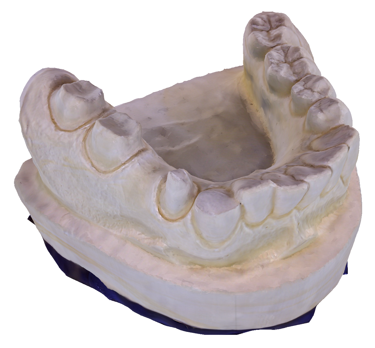 Photogrammetrisch erzeugte Oberfläche eines Gebissabdrucks (positiv)